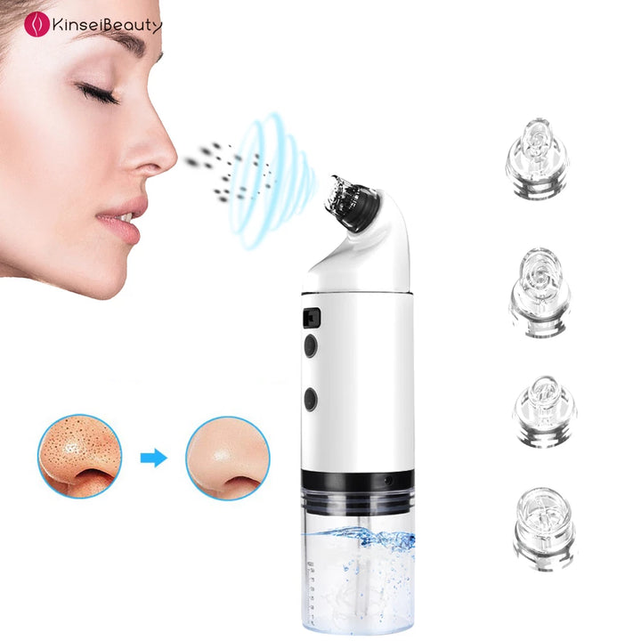 Electric Pore Cleansing Vacuum - product photo 3